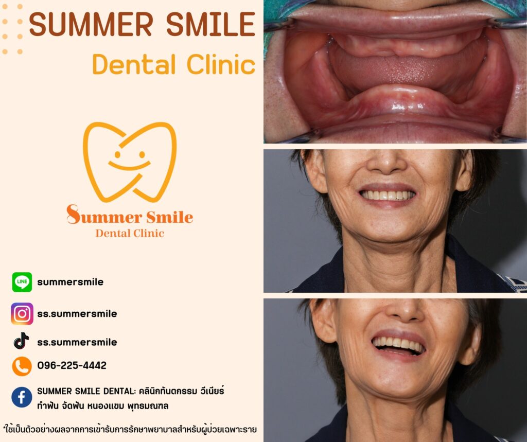 เคสฟันปลอม