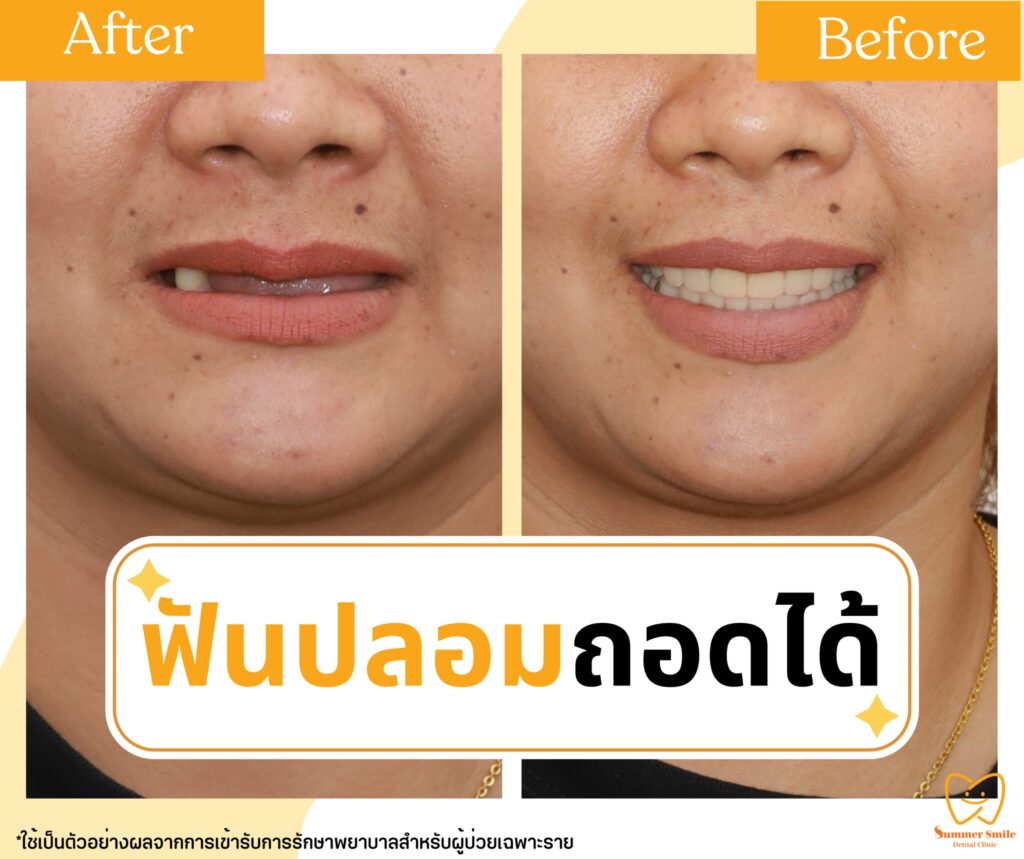 520813707_723422910854012_3482594194729744504_n