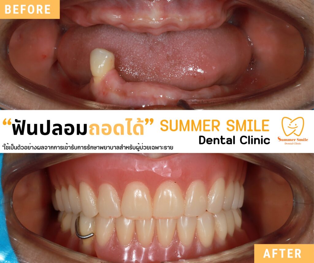 522660525_723422970854006_249277938192267038_n