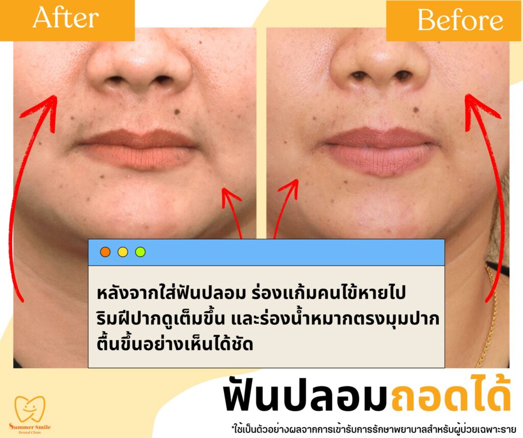 524241036_723422907520679_7054911235694527061_n